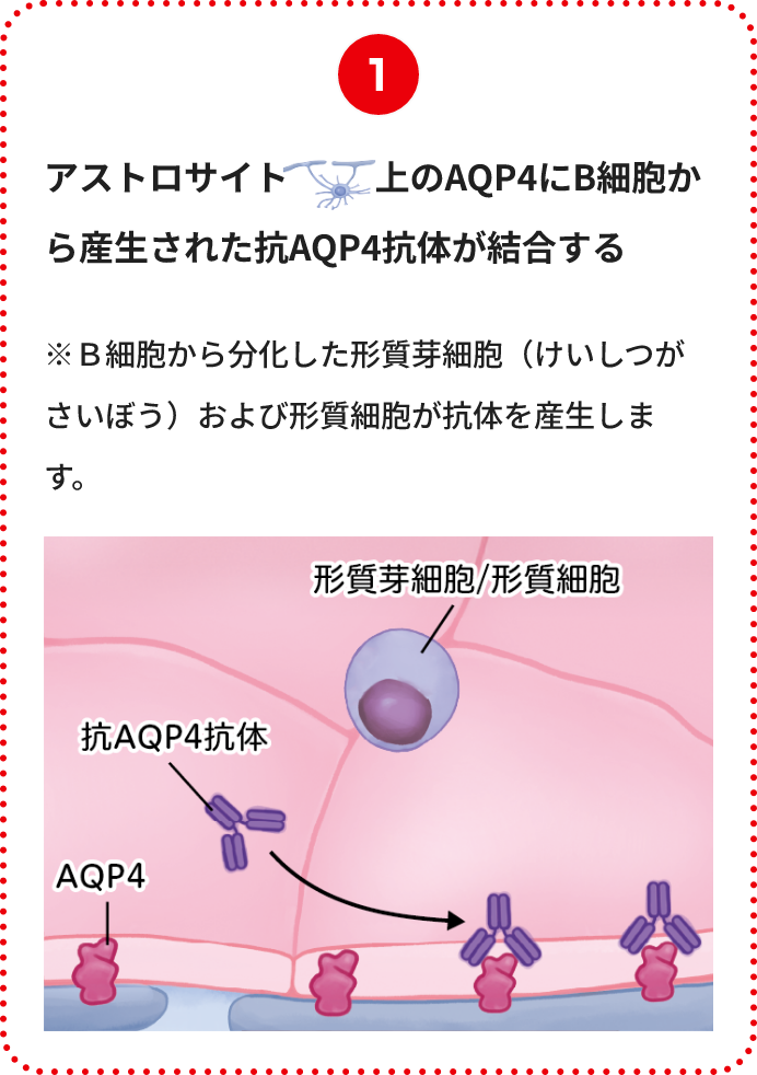 アストロサイト上のAQP4にB細胞から産生された抗AQP4抗体が結合する※Ｂ細胞から分化した形質芽細胞（けいしつがさいぼう）および形質細胞が抗体を産生します。