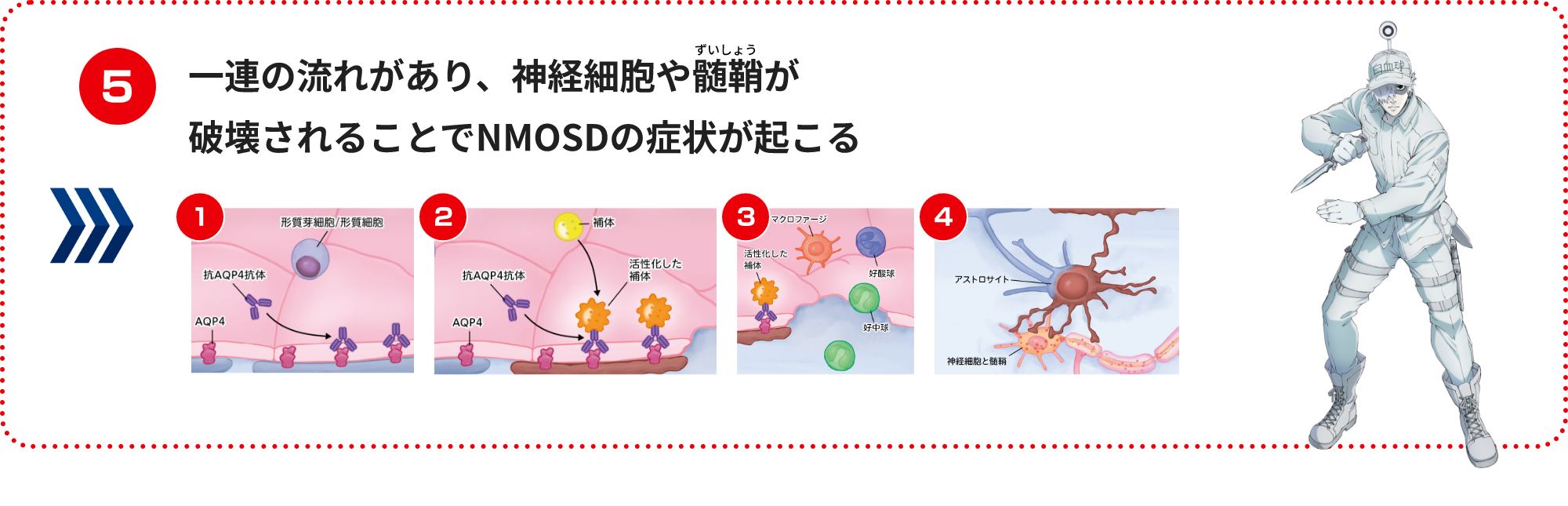 一連の流れがあり、神経細胞や髄鞘が破壊されることでNMOSDの症状が起こる